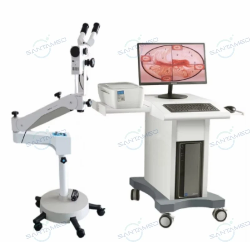 Optoelectronic Colposcope Devices